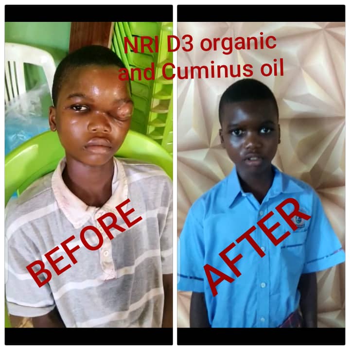 WHY CUMINUS OIL SHOULD BE IN EVERY HOME